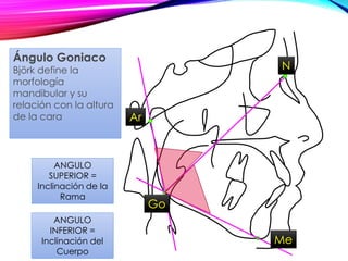 ANGULO
SUPERIOR =
Inclinación de la
Rama
ANGULO
INFERIOR =
Inclinación del
Cuerpo
Ángulo Goniaco
Björk define la
morfología
mandibular y su
relación con la altura
de la cara
Go
N
Ar
Me
 