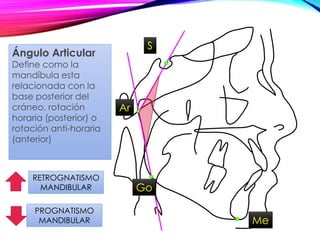 RETROGNATISMO
MANDIBULAR
PROGNATISMO
MANDIBULAR
Ángulo Articular
Define como la
mandíbula esta
relacionada con la
base posterior del
cráneo, rotación
horaria (posterior) o
rotación anti-horaria
(anterior)
Go
Ar
S
Me
 