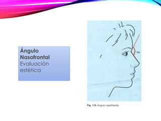 Ángulo
Nasofrontal
Evaluación
estética
 