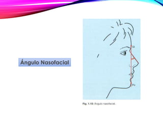 Ángulo Nasofacial
 