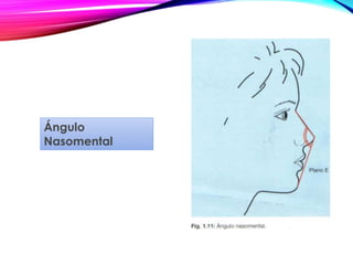 Ángulo
Nasomental
 