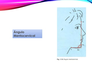 Ángulo
Mentocervical
 