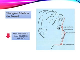 MEJOR PERFIL SI
EL ANGULO ES
AGUDO
Triangulo Estético
de Powell
 