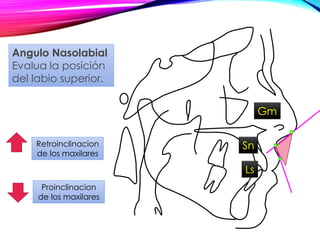 Sn
Gm
Ls
Retroinclinacion
de los maxilares
Angulo Nasolabial
Evalua la posición
del labio superior.
Proinclinacion
de los maxilares
 