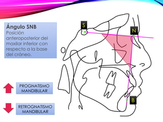 S
N
PROGNATISMO
MANDIBULAR
RETROGNATISMO
MANDIBULAR
Ángulo SNB
Posición
anteroposterior del
maxilar inferior con
respecto a la base
del cráneo.
B
 