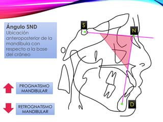 S
N
PROGNATISMO
MANDIBULAR
RETROGNATISMO
MANDIBULAR
Ángulo SND
Ubicación
anteroposterior de la
mandíbula con
respecto a la base
del cráneo
D
 