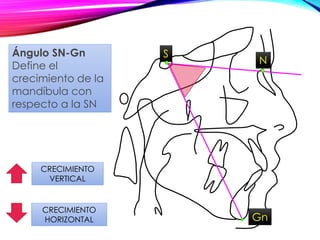 S
N
Gn
CRECIMIENTO
VERTICAL
CRECIMIENTO
HORIZONTAL
Ángulo SN-Gn
Define el
crecimiento de la
mandíbula con
respecto a la SN
 