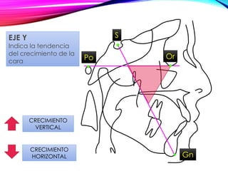 Po Or
Gn
CRECIMIENTO
VERTICAL
CRECIMIENTO
HORIZONTAL
EJE Y
Indica la tendencia
del crecimiento de la
cara
S
 