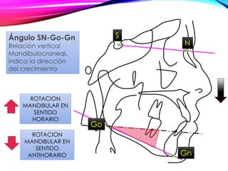 S
N
ROTACION
MANDIBULAR EN
SENTIDO
HORARIO
ROTACION
MANDIBULAR EN
SENTIDO
ANTIHORARIO
Ángulo SN-Go-Gn
Relación vertical
Mandibulocraneal,
indica la dirección
del crecimiento
Gn
Go
 