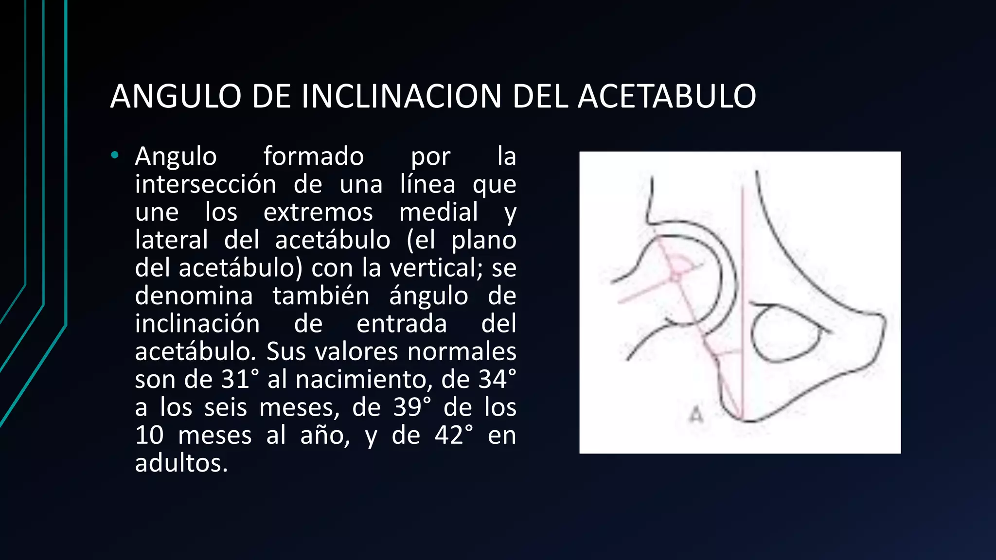 Angulos en traumatologia | PPTX