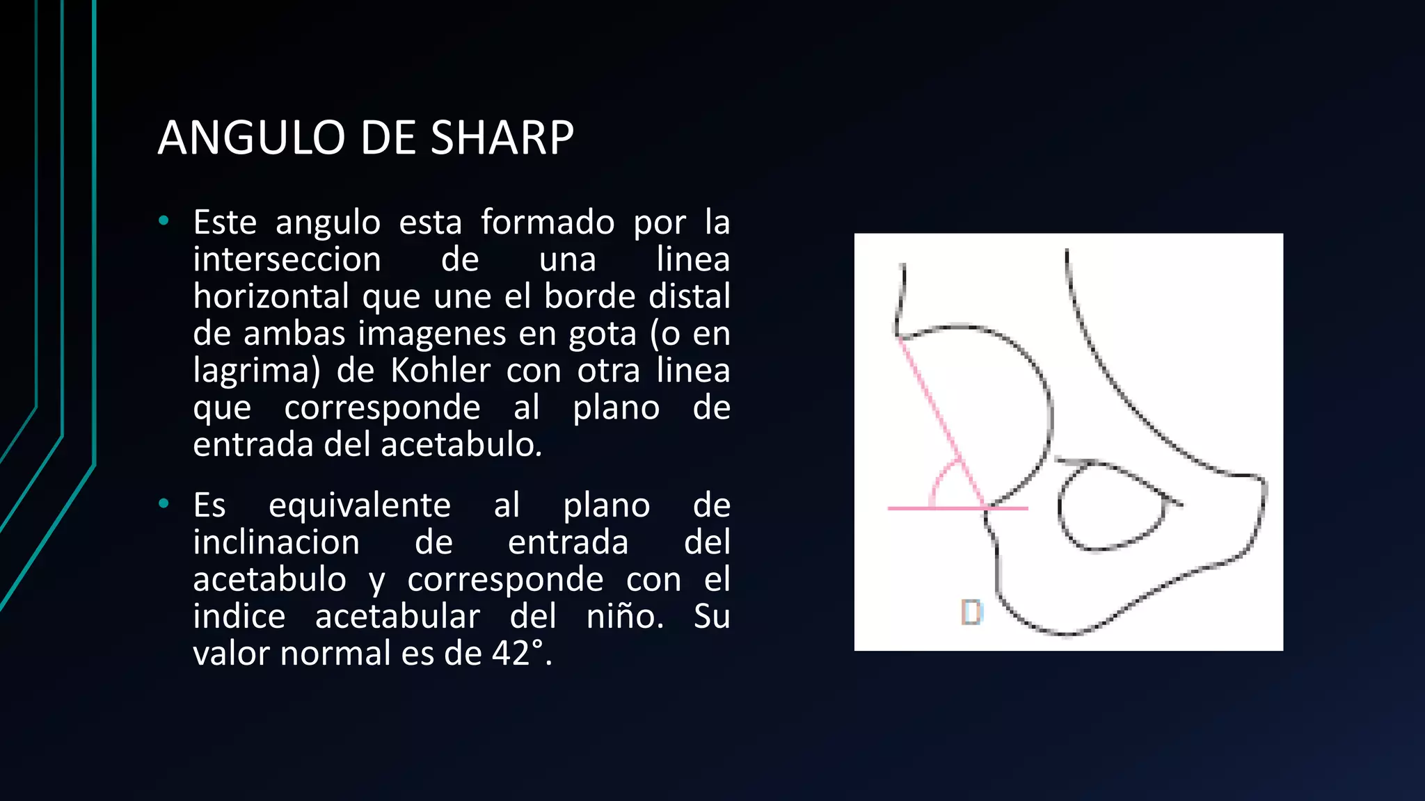 Angulos en traumatologia | PPTX