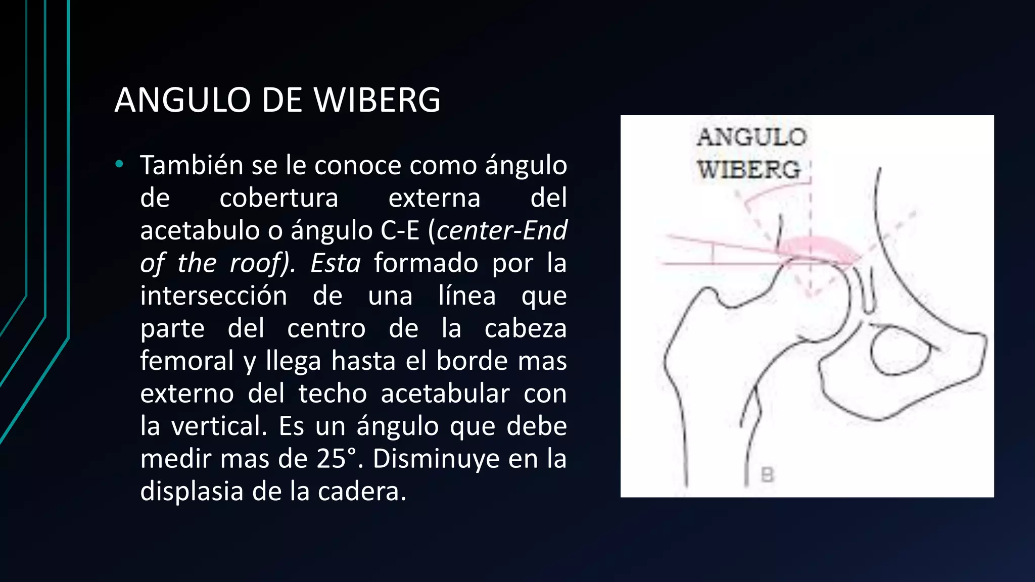 Angulos en traumatologia | PPTX
