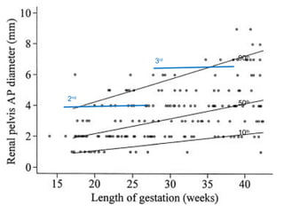 90 th   10 th   50 th   2 nd   3 rd   