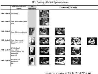 Pediatr Radiol (1993) 23:478-480 