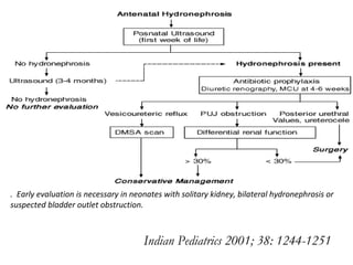 Indian Pediatrics 2001; 38: 1244-1251    .  Early evaluation is necessary in neonates with solitary kidney, bilateral hydronephrosis or suspected bladder outlet obstruction.  