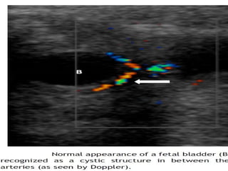 Renal Physiology Urine formation- first seen at the 5-8th week. Urine output  5 cc/h at the 20th week  50 cc/h by the 40th week. Bladder : visualized by  10-14th week  Bladder capacity  10 cc at the 30th week to 50 cc at term Br J Obstet Gynaecol 1977;84:205. 