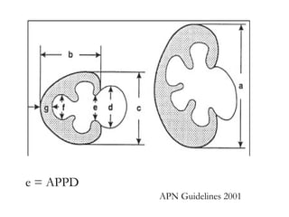 <ul><li>APN Guidelines 2001 </li></ul>e = APPD 