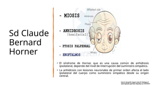 Anhydrosis Icon Anhidrosis Dermatologia 2023 Exposicion | PPT