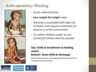 Core disciplines in agriculture-nutrition-health research: Nutrition