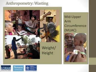 Core disciplines in agriculture-nutrition-health research: Nutrition