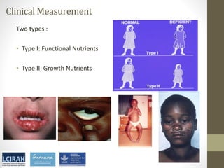 Core disciplines in agriculture-nutrition-health research: Nutrition
