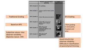Antenatalhydronephrosis 2022may (1).pptx