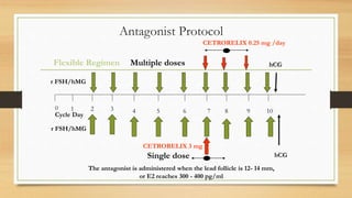 Antagonist Protocol
0 1 2 3 4 5 6 7 8 9 10
Flexible Regimen
Single dose
CETRORELIX 3 mg
CETRORELIX 0.25 mg /day
r FSH/hMG
r FSH/hMG
hCG
hCG
Cycle Day
Multiple doses
The antagonist is administered when the lead follicle is 12- 14 mm,
or E2 reaches 300 - 400 pg/ml
 
