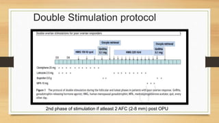 Double Stimulation protocol
2nd phase of stimulation if atleast 2 AFC (2-8 mm) post OPU
 