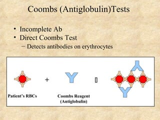 Coombs (Antiglobulin)Tests 
• Incomplete Ab 
• Direct Coombs Test 
– Detects antibodies on erythrocytes 
+  
Patient’s RBCs Coombs Reagent 
(Antiglobulin) 
 