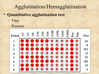 Agglutination/Hemagglutination 
• Quantitative agglutination test 
– Titer 
– Prozone 
1/2 
1/4 
1/8 
1/16 
1/32 
1/64 
1/128 
1/256 
1/512 
1/1024 
Pos. 
Neg. 
Titer 
64 
8 
512 
<2 
32 
128 
32 
4 
Patient 
1 
2 
3 
4 
5 
6 
7 
8 
 