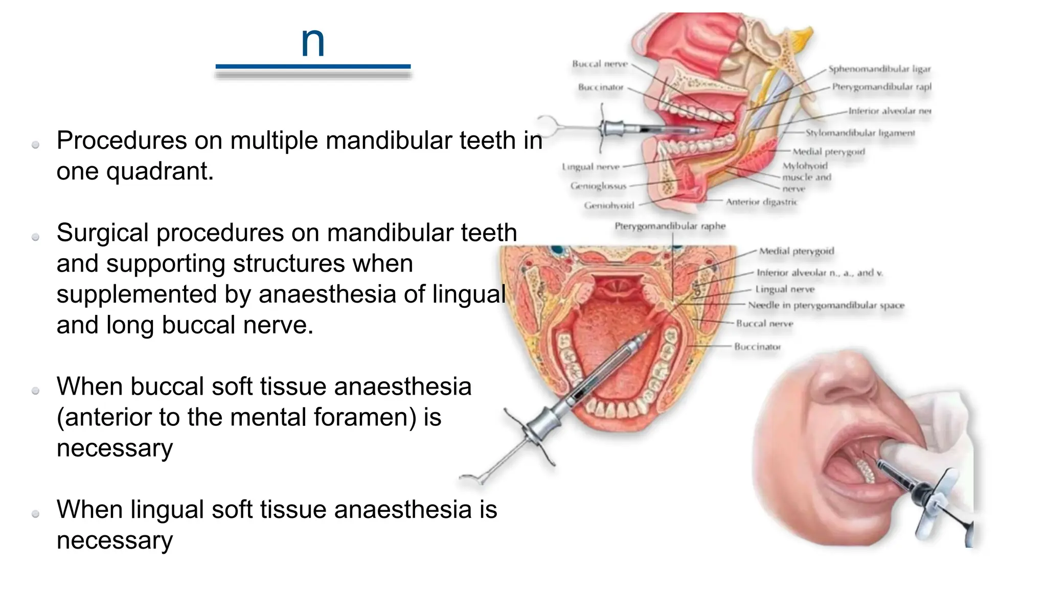 Inferior Alveolar Nerve Block Anesthetic Technique PPT