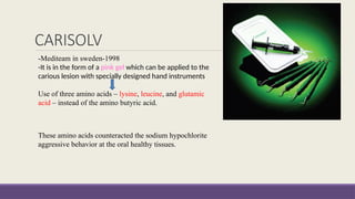 endodontics ANILA-NON ROTARY METHODS.pptx