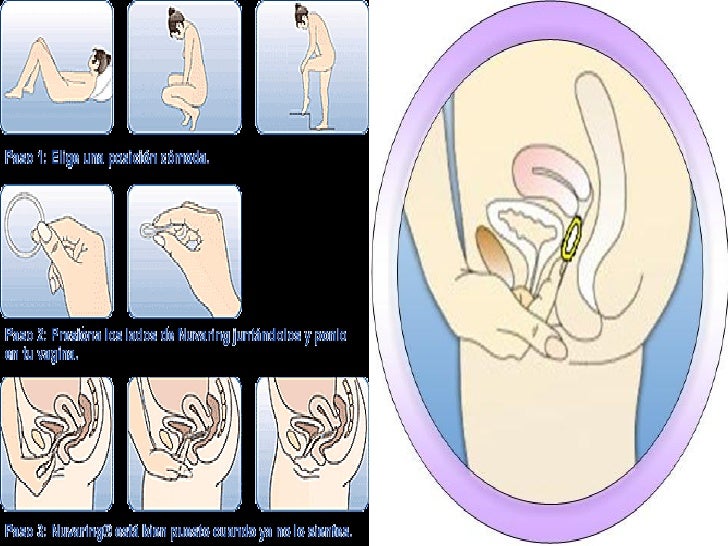 Cuanto cuesta cambiar el anillo del airbag