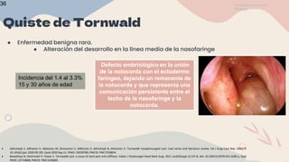 ANILLO DE WALDEYER.pptx ANILLO DE WALDEYER ANILLO DE WALDEYER | PPTX