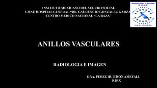 ANILLOS VASCULARES
RADIOLOGIA E IMAGEN
INSTITUTO MEXICANO DEL SEGURO SOCIAL
UMAE HOSPITAL GENERAL “DR. GAUDENCIO GONZALEZ GARZA”
CENTRO MEDICO NACIONAL “LA RAZA”
DRA. PÉREZ HUITRÓN AMEYALI
R1RX
 