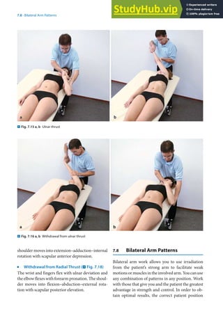 7
119
7.8 · Bilateral Arm Patterns
shoulder moves into extension–adduction–internal
rotation with scapular anterior depression.
j
Withdrawal from Radial Thrust (. Fig. 7.18)
The wrist and fingers flex with ulnar deviation and
the elbow flexes with forearm pronation. The shoul-
der moves into flexion–abduction–external rota-
tion with scapular posterior elevation.
7.8 Bilateral Arm Patterns
Bilateral arm work allows you to use irradiation
from the patient’s strong arm to facilitate weak
motions or muscles in the involved arm. You can use
any combination of patterns in any position. Work
with those that give you and the patient the greatest
advantage in strength and control. In order to ob-
tain optimal results, the correct patient position
. Fig. 7.15 a, b Ulnar thrust
. Fig. 7.16 a, b Withdrawal from ulnar thrust
 