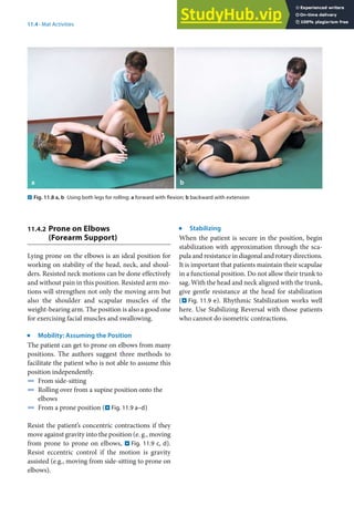 11
205
11.4 · Mat Activities
. Fig. 11.8 a, b Using both legs for rolling: a forward with flexion; b backward with extension
11.4.2 Prone on Elbows
(Forearm Support)
Lying prone on the elbows is an ideal position for
working on stability of the head, neck, and shoul-
ders. Resisted neck motions can be done effectively
and without pain in this position. Resisted arm mo-
tions will strengthen not only the moving arm but
also the shoulder and scapular muscles of the
weight-bearing arm. The position is also a good one
for exercising facial muscles and swallowing.
j
Mobility: Assuming the Position
The patient can get to prone on elbows from many
positions. The authors suggest three methods to
facilitate the patient who is not able to assume this
position independently.
4 From side-sitting
4 Rolling over from a supine position onto the
elbows
4 From a prone position (. Fig. 11.9 a–d)
Resist the patient’s concentric contractions if they
move against gravity into the position (e. g., moving
from prone to prone on elbows, . Fig. 11.9 c, d).
Resist eccentric control if the motion is gravity
assisted (e.g., moving from side-sitting to prone on
elbows).
j
Stabilizing
When the patient is secure in the position, begin
stabilization with approximation through the sca-
pula and resistance in diagonal and rotary directions.
It is important that patients maintain their scapulae
in a functional position. Do not allow their trunk to
sag. With the head and neck aligned with the trunk,
give gentle resistance at the head for stabilization
(. Fig. 11.9 e). Rhythmic Stabilization works well
here. Use Stabilizing Reversal with those patients
who cannot do isometric contractions.
 