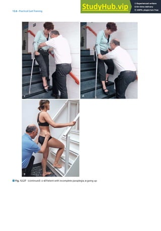 12
267
12.6 · Practical Gait Training
. Fig. 12.27 (continued) c–d Patient with incomplete paraplegia; e going up
e
d
c
 