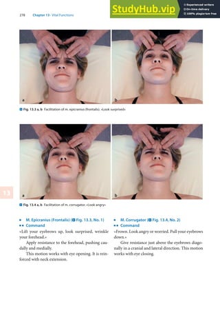 278 Chapter 13 · Vital Functions
13
j
M. Epicranius (Frontalis) (. Fig. 13.3, No. 1)
k
Command
»Lift your eyebrows up, look surprised, wrinkle
your forehead.«
Apply resistance to the forehead, pushing cau-
dally and medially.
This motion works with eye opening. It is rein-
forced with neck extension.
. Fig. 13.3 a, b Facilitation of m. epicranius (frontalis). »Look surprised«
a b
. Fig. 13.4 a, b Facilitation of m. corrugator. »Look angry«
a b
j
M. Corrugator (. Fig. 13.4, No. 2)
k
Command
»Frown. Look angry or worried. Pull your eyebrows
down.«
Give resistance just above the eyebrows diago-
nally in a cranial and lateral direction. This motion
works with eye closing.
 