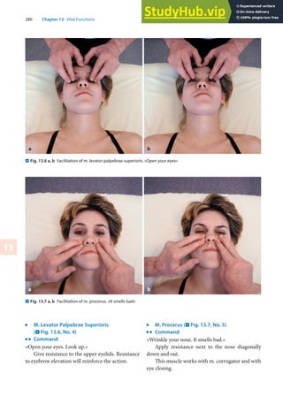 280 Chapter 13 · Vital Functions
13
j
M. Levator Palpebrae Superioris
(. Fig. 13.6, No. 4)
k
Command
»Open your eyes. Look up.«
Give resistance to the upper eyelids. Resistance
to eyebrow elevation will reinforce the action.
j
M. Procerus (. Fig. 13.7, No. 5)
k
Command
»Wrinkle your nose. It smells bad.«
Apply resistance next to the nose diagonally
down and out.
This muscle works with m. corrugator and with
eye closing.
. Fig. 13.6 a, b Facilitation of m. levator palpebrae superioris. »Open your eyes«
. Fig. 13.7 a, b Facilitation of m. procerus. »It smells bad«
 