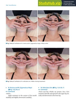 13
281
13.2 · Facial Muscles
j
M. Risorius and M. Zygomaticus Major
(. Fig. 13.8, No. 6)
k
Command
»Smile.«
Apply resistance to the corners of the mouth
medially and slightly downward (caudally).
j
M. Orbicularis Oris (. Fig. 13.9, No. 7)
k
Command
»Purse your lips, whistle, say ›prunes‹, kiss.« Give
resistance laterally and upward to the upper lip, lat-
erally and downward to the lower lip.
. Fig. 13.8 a, b Facilitation of m. risorius and m. zygomaticus major. »Please smile«
. Fig. 13.9 a, b Facilitation of m. orbicularis oris. »Make a kissing movement«
 