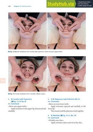 282 Chapter 13 · Vital Functions
13
j
M. Levator Labii Superioris
(. Fig. 13.10, No. 8)
k
Command
»Show your upper teeth.«
Apply resistance to the upper lip, downward and
medially.
j
9. M. Depressor Labii Inferioris (No. 9)
k
Command
»Show me your lower teeth«
Apply resistance upward and medially to the
lower lip.
This muscle and the platysma work together.
j
M. Mentalis (. Fig. 13.11, No. 10)
k
Command
»Wrinkle your chin.«
Apply resistance down and out at the chin.
. Fig. 13.10 a, b Facilitation of m. levator labii superioris. »Show me your upper teeth«
. Fig. 13.11 a, b Facilitation of m. mentalis. »Make a pout«
a b
 