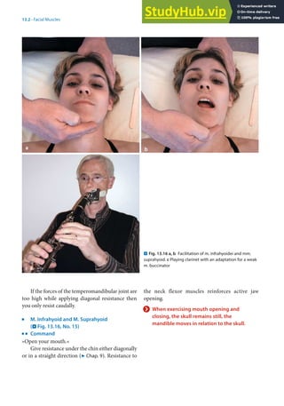 13
285
13.2 · Facial Muscles
If the forces of the temperomandibular joint are
too high while applying diagonal resistance then
you only resist caudally.
j
M. Infrahyoid and M. Suprahyoid
(. Fig. 13.16, No. 15)
k
Command
»Open your mouth.«
Give resistance under the chin either diagonally
or in a straight direction (7 Chap. 9). Resistance to
c
. Fig. 13.16 a, b Facilitation of m. infrahyoidei and mm.
suprahyoid. c Playing clarinet with an adaptation for a weak
m. buccinator
the neck flexor muscles reinforces active jaw
opening.
> When exercising mouth opening and
closing, the skull remains still, the
mandible moves in relation to the skull.
 