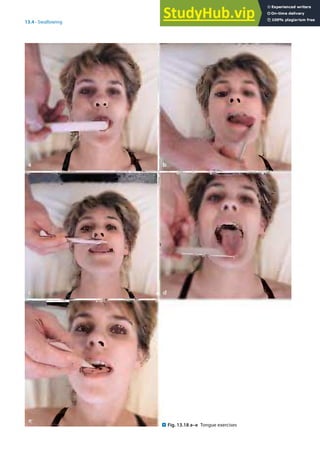 13
287
13.4 · Swallowing
. Fig. 13.18 a–e Tongue exercises
 