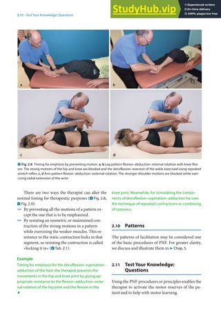 2
27
2.11 · Test Your Knowledge: Questions
. Fig. 2.8 Timing for emphasis by preventing motion. a, b Leg pattern flexion–abduction–internal rotation with knee flex-
ion. The strong motions of the hip and knee are blocked and the dorsiflexion–eversion of the ankle exercised using repeated
stretch reflex. c, d Arm pattern flexion–abduction–external rotation. The stronger shoulder motions are blocked while exer-
cising radial extension of the wrist
a b
There are two ways the therapist can alter the
normal timing for therapeutic purposes (. Fig. 2.8,
. Fig. 2.9):
4 By preventing all the motions of a pattern ex-
cept the one that is to be emphasized.
4 By resisting an isometric or maintained con-
traction of the strong motions in a pattern
while exercising the weaker muscles. This re-
sistance to the static contraction locks in that
segment, so resisting the contraction is called
»locking it in« (. Tab. 2.1).
Example
Timing for emphasis for the dorsiflexion–supination–
adduction of the foot: the therapist prevents the
movements in the hip and knee joint by giving ap-
propriate resistance to the flexion–adduction–exter-
nal rotation of the hip joint and the flexion in the
knee joint. Meanwhile, for stimulating the compo-
nents of dorsiflexion–supination–adduction he uses
the technique of repeated contractions or combining
of isotonics.
2.10 Patterns
The patterns of facilitation may be considered one
of the basic procedures of PNF. For greater clarity,
we discuss and illustrate them in 7 Chap. 5.
2.11 Test Your Knowledge:
Questions
Using the PNF procedures or principles enables the
therapist to activate the motor reserves of the pa-
tient and to help with motor learning.
6
 