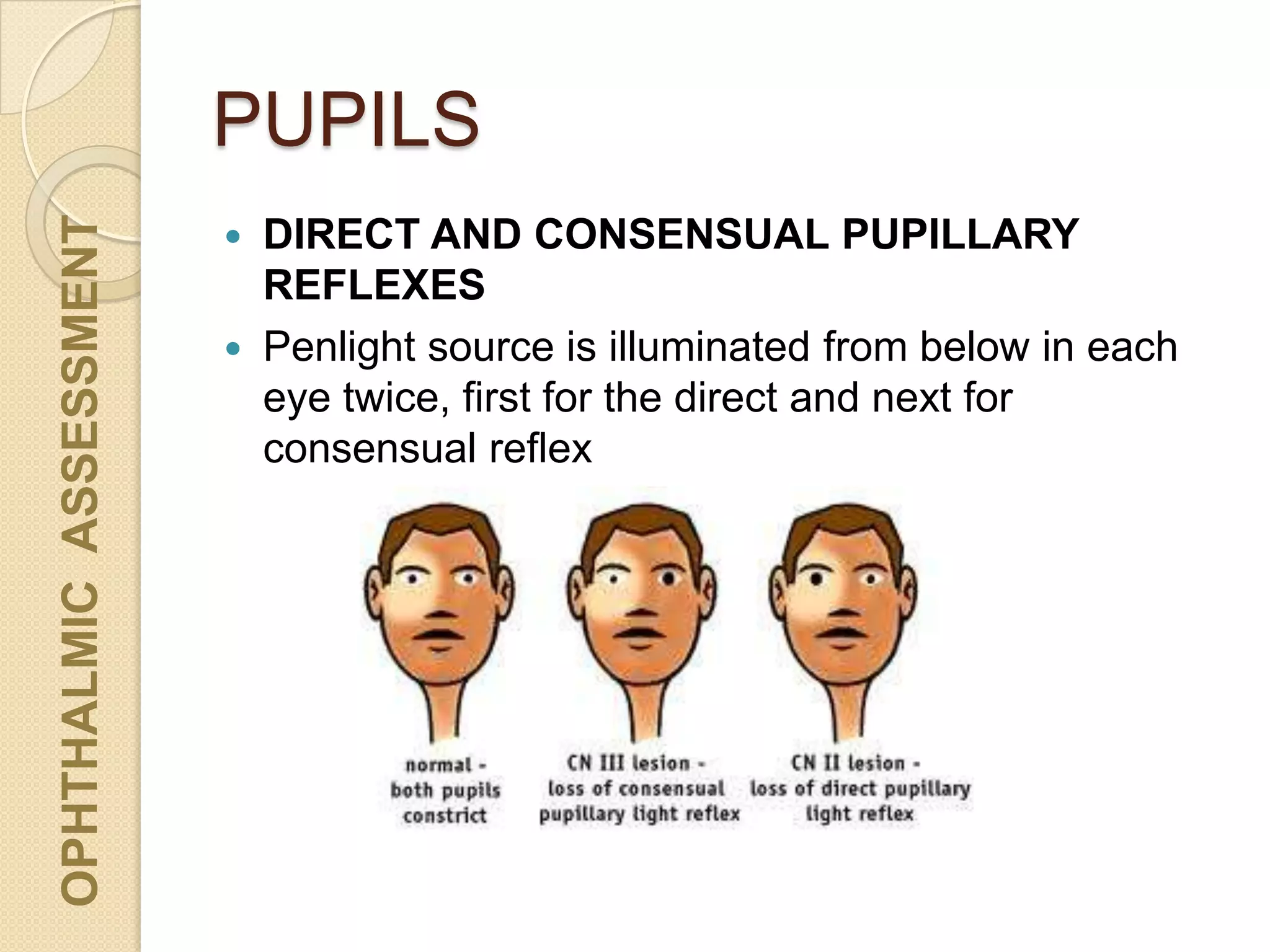 PUPILS
OPHTHALMICASSESSMENT
 DIRECT AND CONSENSUAL PUPILLARY
REFLEXES
 Penlight source is illuminated from below in each
eye twice, first for the direct and next for
consensual reflex
 