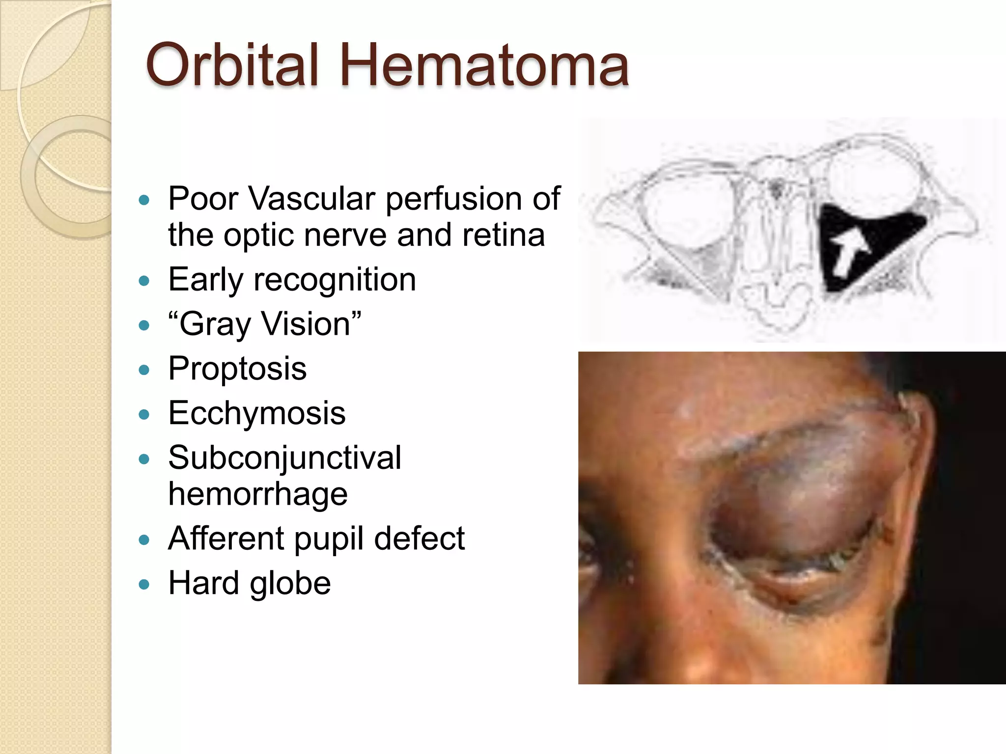 Orbital Hematoma
 Poor Vascular perfusion of
the optic nerve and retina
 Early recognition
 “Gray Vision”
 Proptosis
 Ecchymosis
 Subconjunctival
hemorrhage
 Afferent pupil defect
 Hard globe
 