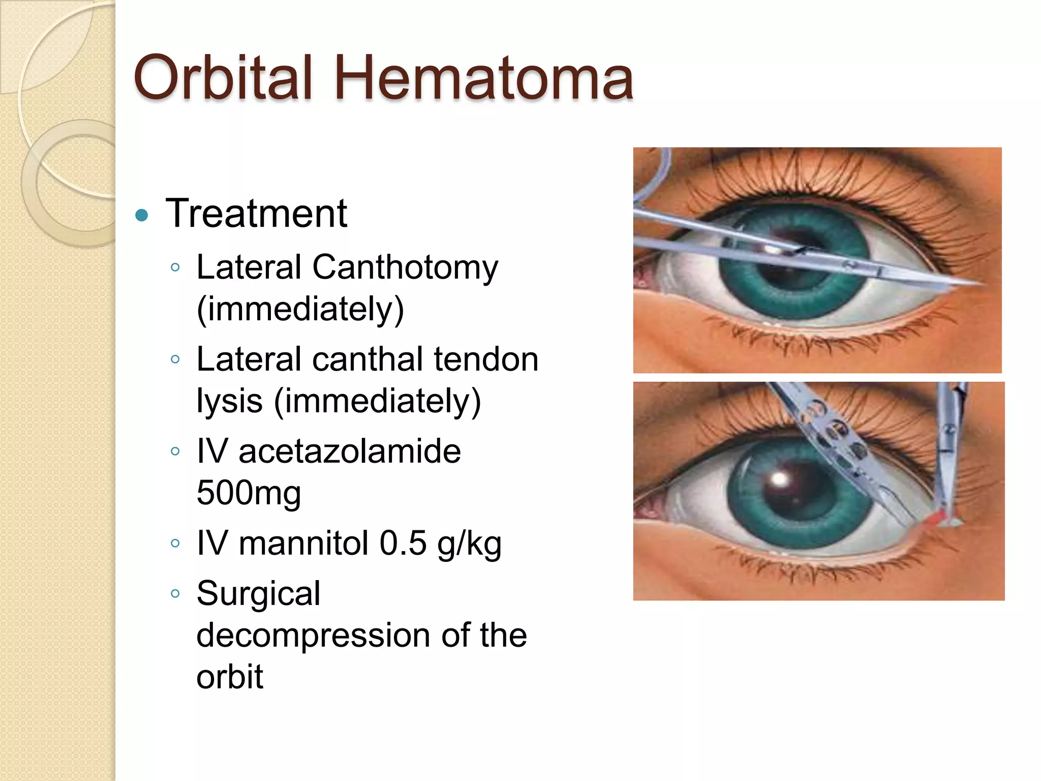 Orbital Hematoma
 Treatment
◦ Lateral Canthotomy
(immediately)
◦ Lateral canthal tendon
lysis (immediately)
◦ IV acetazolamide
500mg
◦ IV mannitol 0.5 g/kg
◦ Surgical
decompression of the
orbit
 