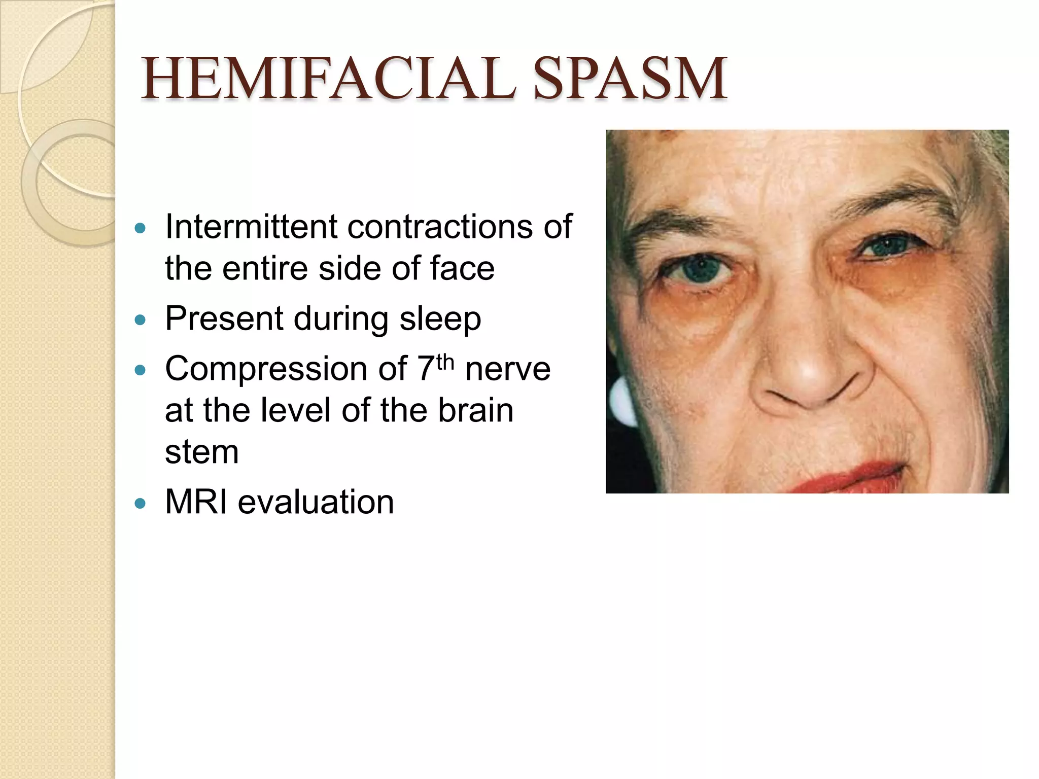 HEMIFACIAL SPASM
 Intermittent contractions of
the entire side of face
 Present during sleep
 Compression of 7th nerve
at the level of the brain
stem
 MRI evaluation
 