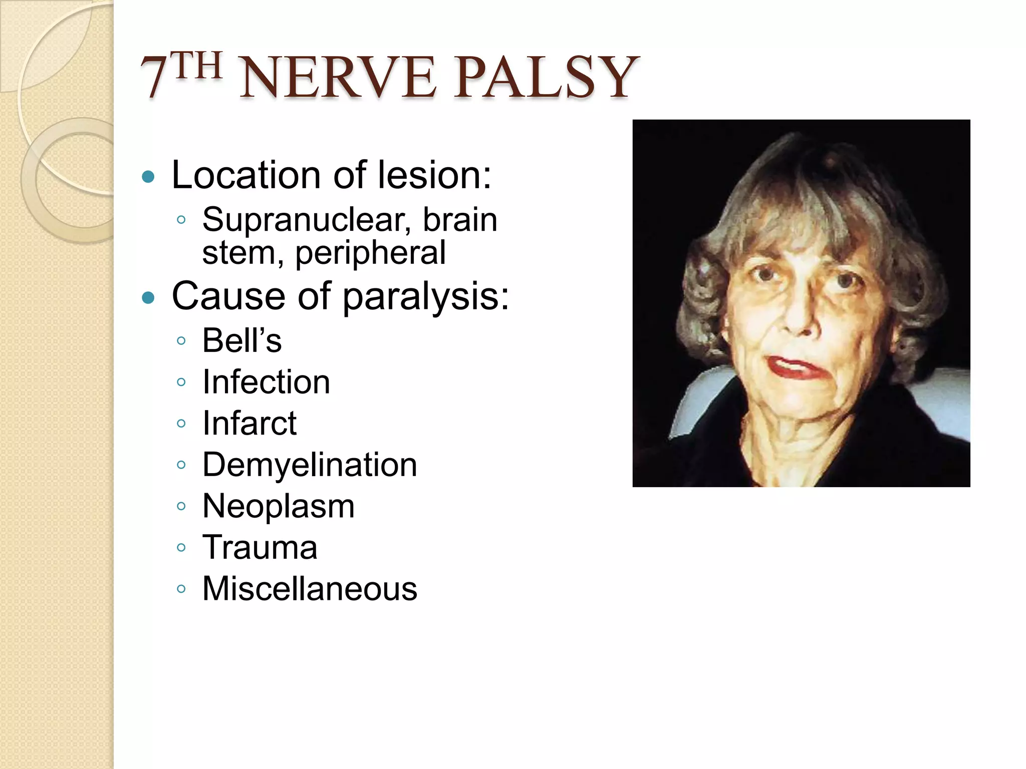 7TH NERVE PALSY
 Location of lesion:
◦ Supranuclear, brain
stem, peripheral
 Cause of paralysis:
◦ Bell’s
◦ Infection
◦ Infarct
◦ Demyelination
◦ Neoplasm
◦ Trauma
◦ Miscellaneous
 